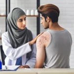 Nowoczesne podejścia w leczeniu atopowego zapalenia skóry